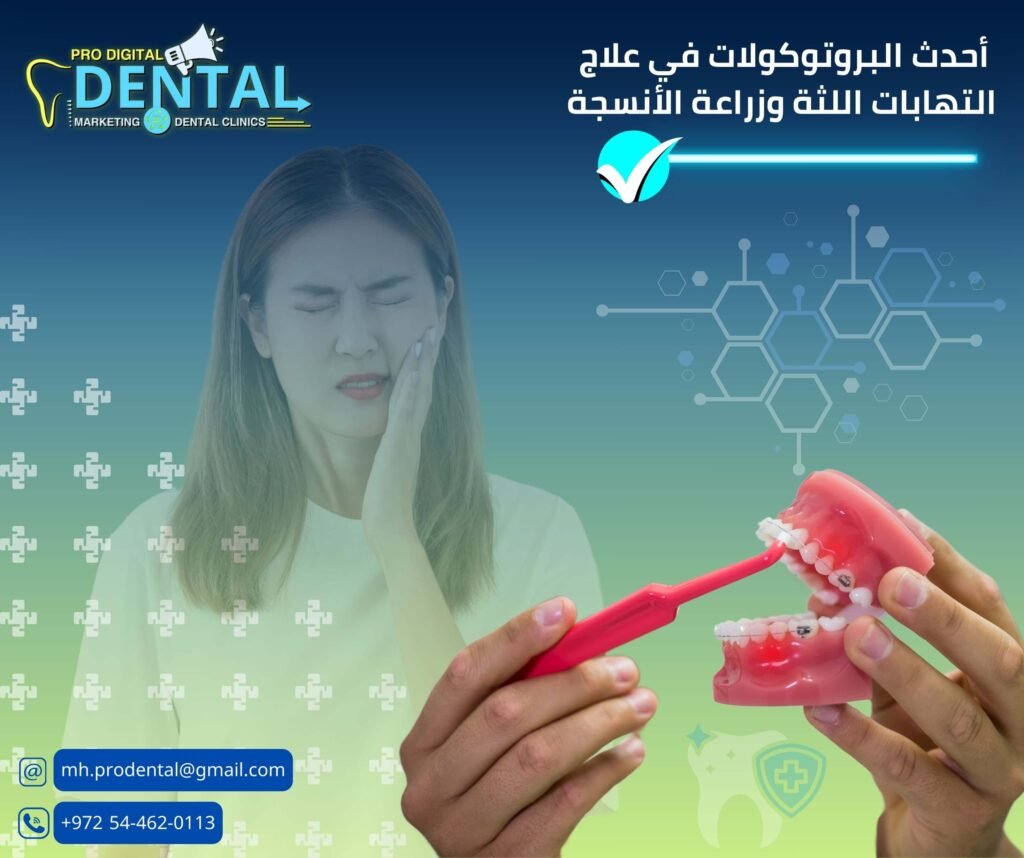 أحدث البروتوكولات في علاج امراض اللثة وزراعة الأنسجة