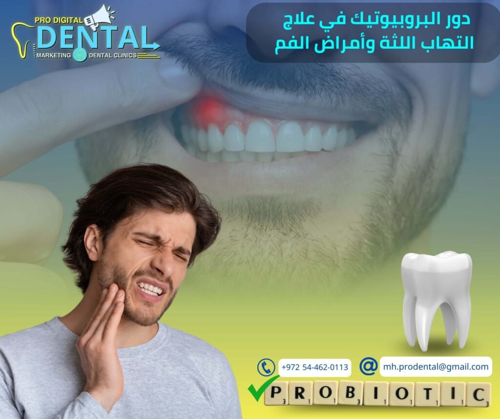 دور البروبيوتيك في علاج التهاب اللثة وأمراض الفم